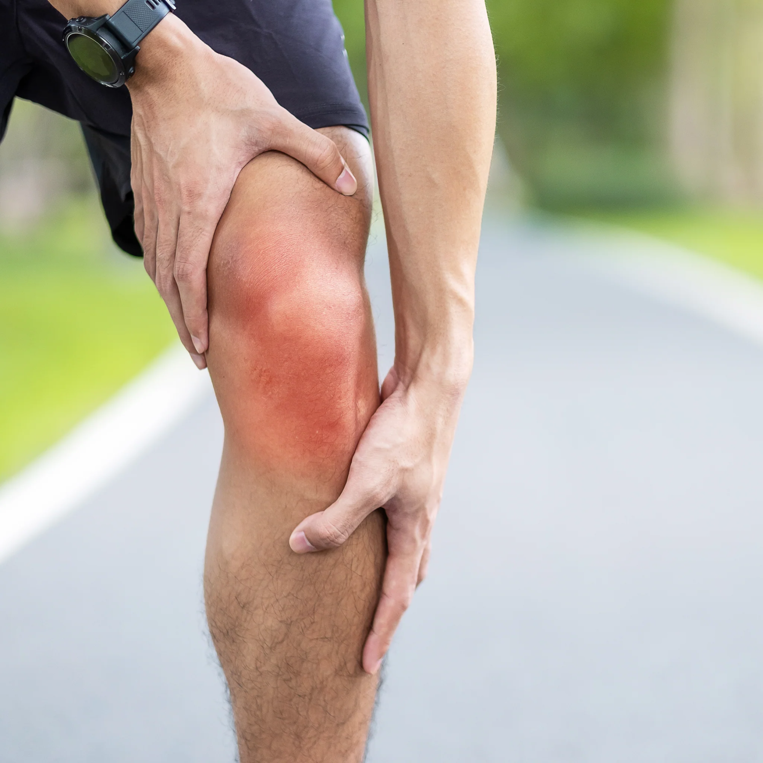Ilustración anatómica de una articulación de rodilla